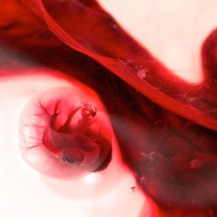 A cover of "blood wisdom 🩸" cluster. The owner is sophburns. The cluster description is "menstruation is a gift". The cluster consists of 48 elements.